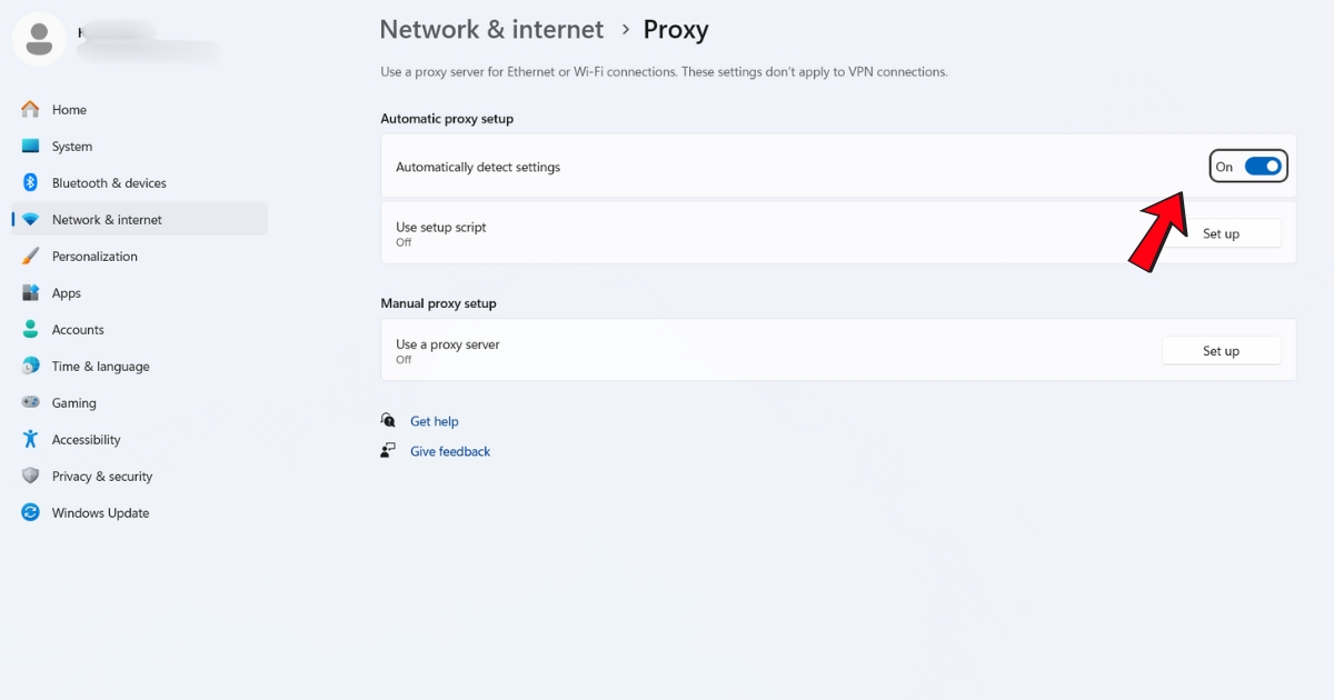 Bạn tìm đến mục Automatically detect settings